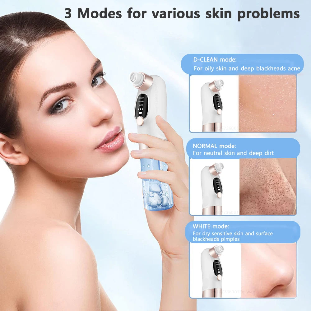 Deep Cleaning Black Head Remover - MONLANE