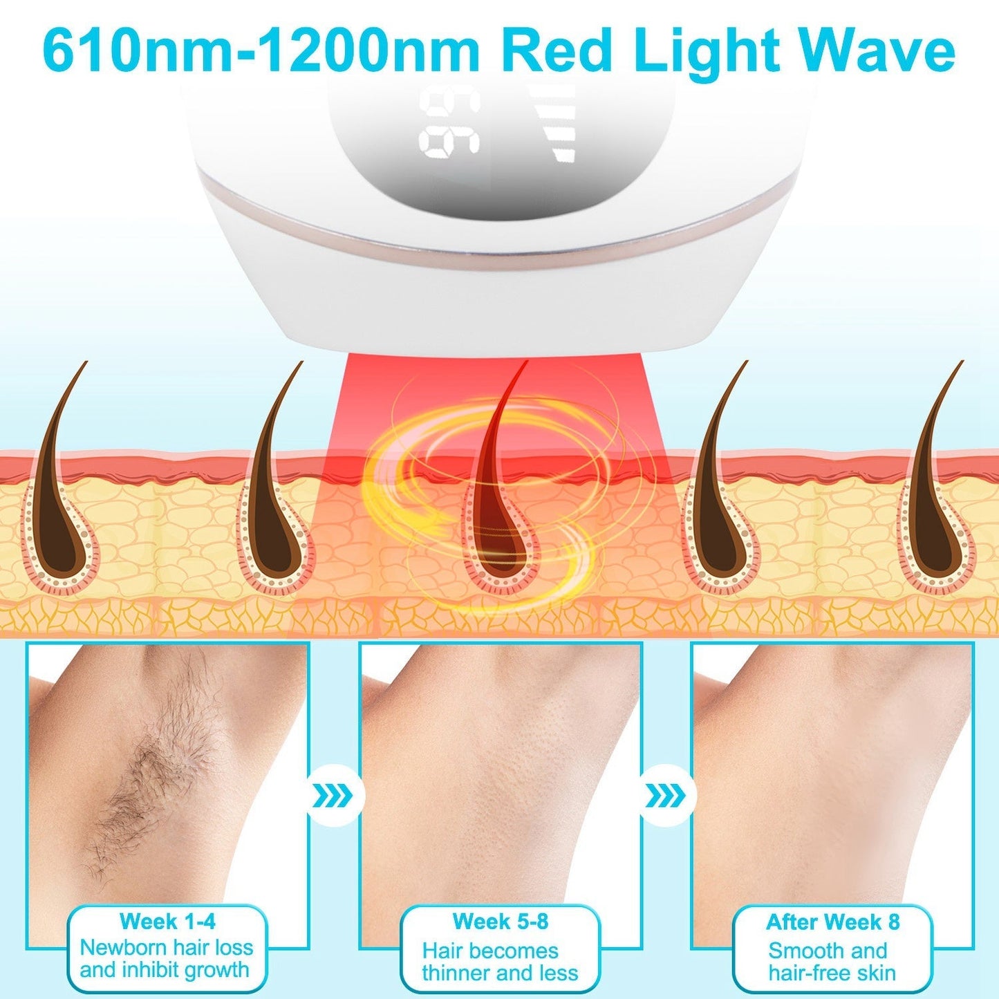 Laser Hair Removal - MONLANE