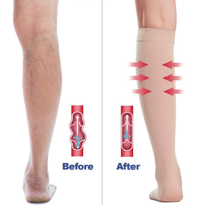 Open Toe Knee High Calf Compression Socks (U CARE) - MONLANE