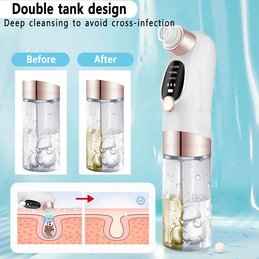 Deep Cleaning  Black Head Remover - MONLANE