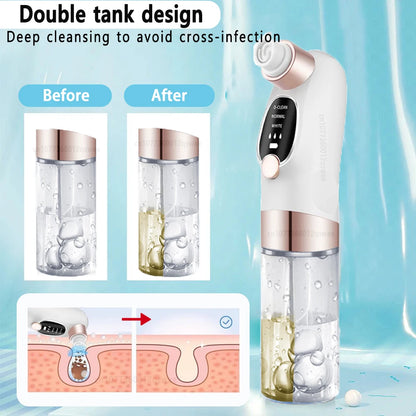 Deep Cleaning  Black Head Remover - MONLANE