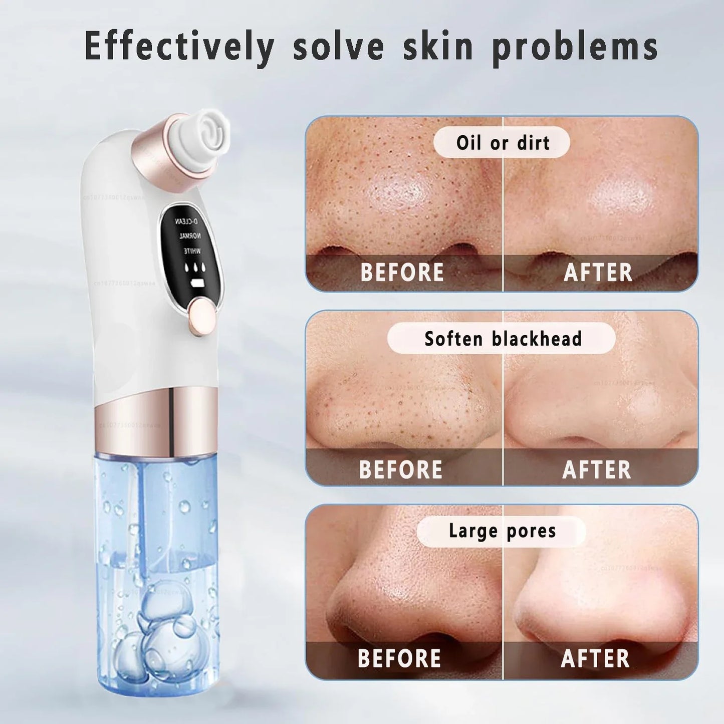 Deep Cleaning Black Head Remover