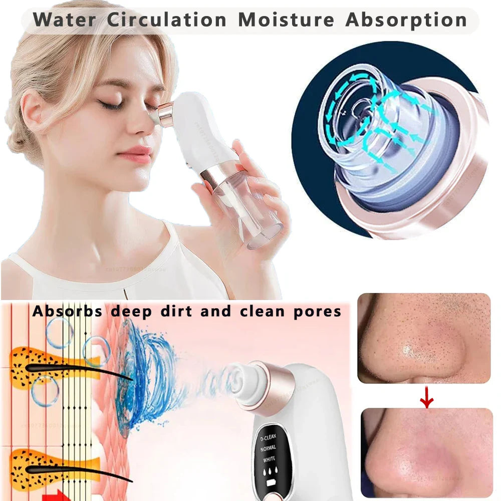 Deep Cleaning Black Head Remover