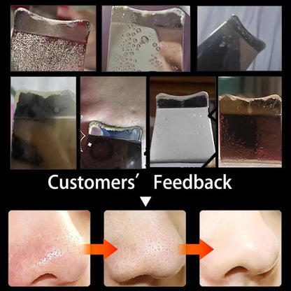 Skin Peeling Machine